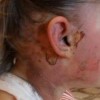 В Харькове парень облил 18-летнюю девушку самогоном и поджог