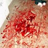В Киевской области азербайджанец в больнице попытался зарезать врача
