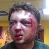 В Киеве избили идеолога FEMEN 