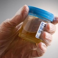 Британские инженеры смогли зарядить мобильный телефон мочой